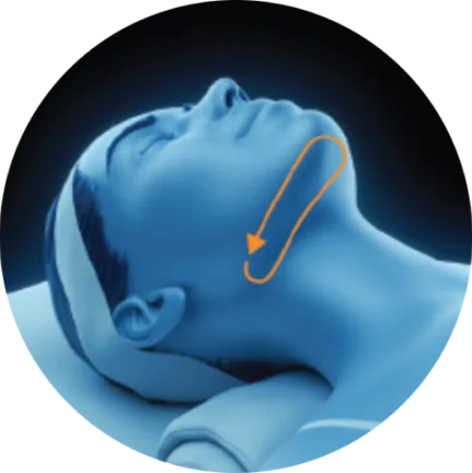 Submentum double chin area